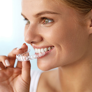 invisalign